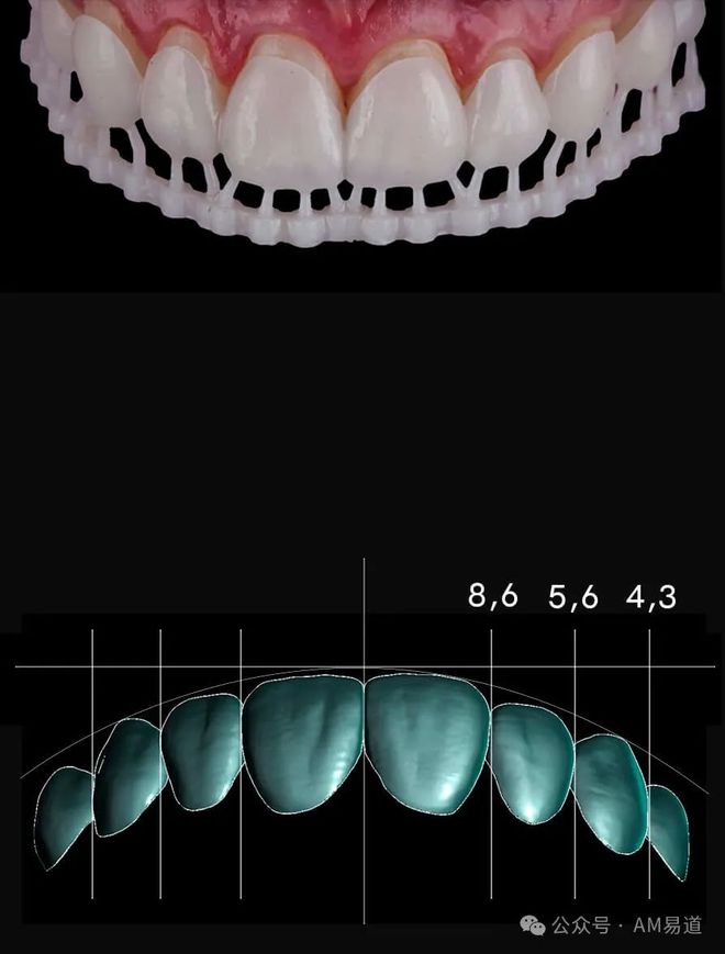 齿科3D打印深度盘点及展望增长势不可挡？(图2)